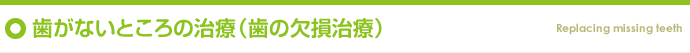 歯がないところの治療（歯の欠損治療）